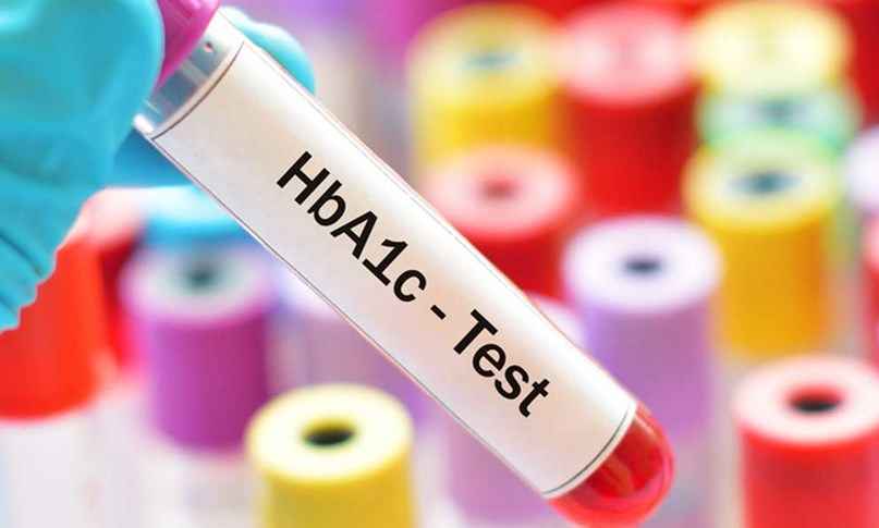 HbA1c Testi